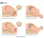 training asuhan persalinan normal mempraktikkan teknik persalinan dengan instruktur medis.